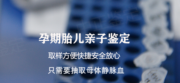 南昌孕期亲子鉴定需要怎么办理,南昌产前亲子鉴定准确率高吗 南昌孕期亲子鉴定需要怎么办理,南昌产前亲子鉴定准确率高吗